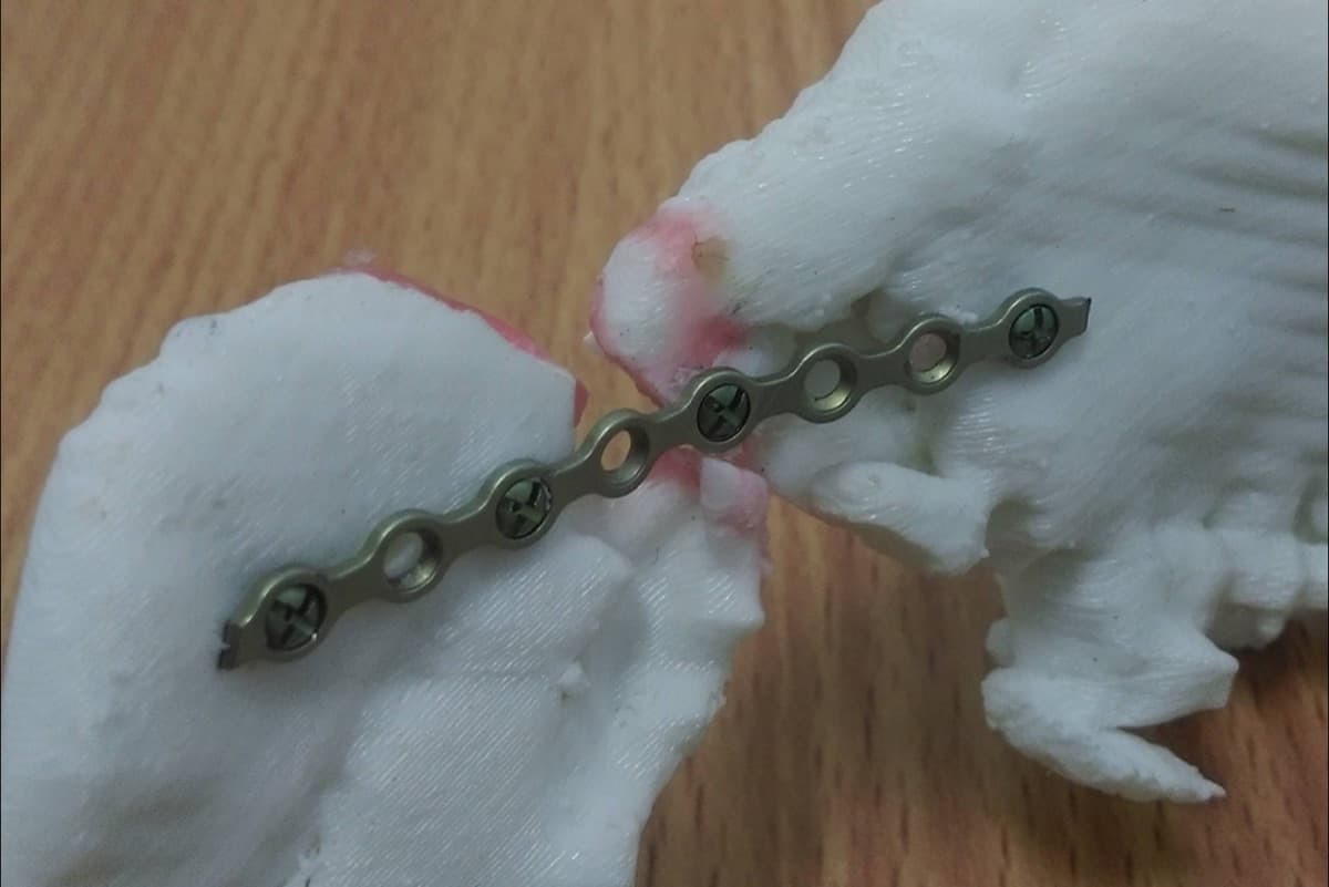 Dental crown and bridge model